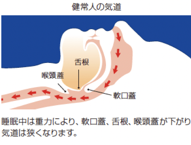 健常人の気道